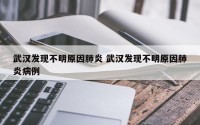 武汉发现不明原因肺炎 武汉发现不明原因肺炎病例